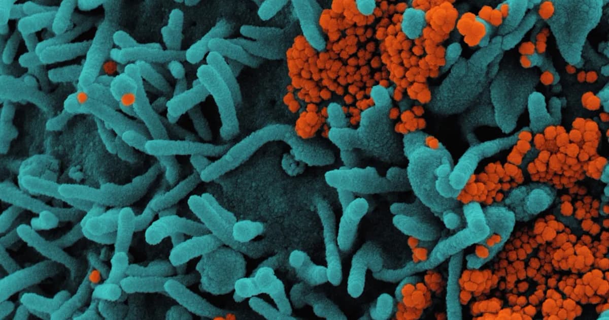 Antimicrobial Peptides: The Structural Classes and How They Act on Membranes